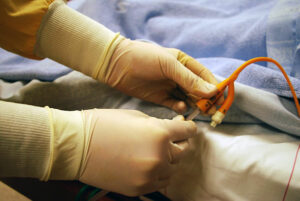 Image of medical catheter made from TPR rubber material. 