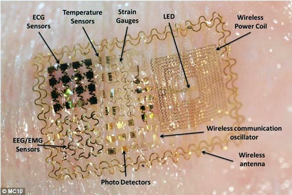 Flexible circuitry for medical wearables.