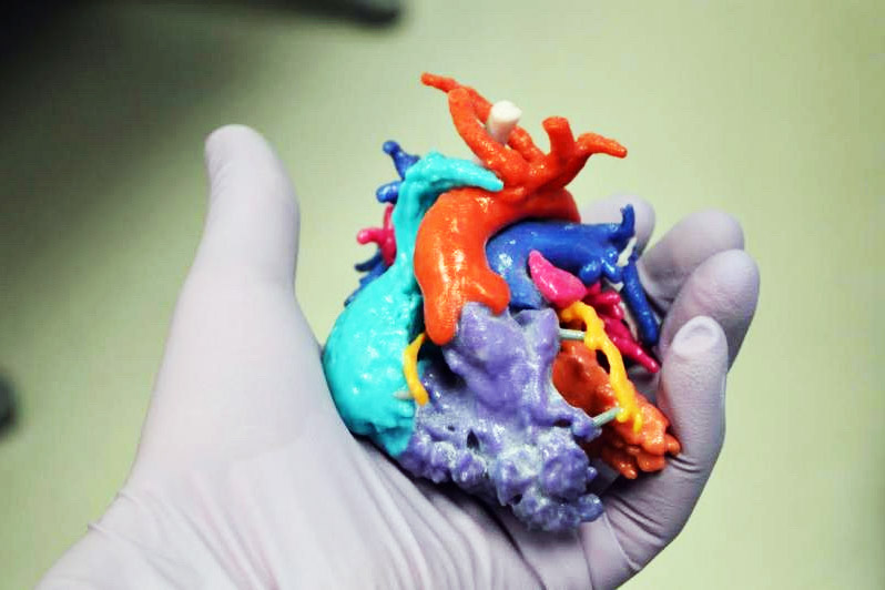 Cardiovascular heart model, Star Rapid blog